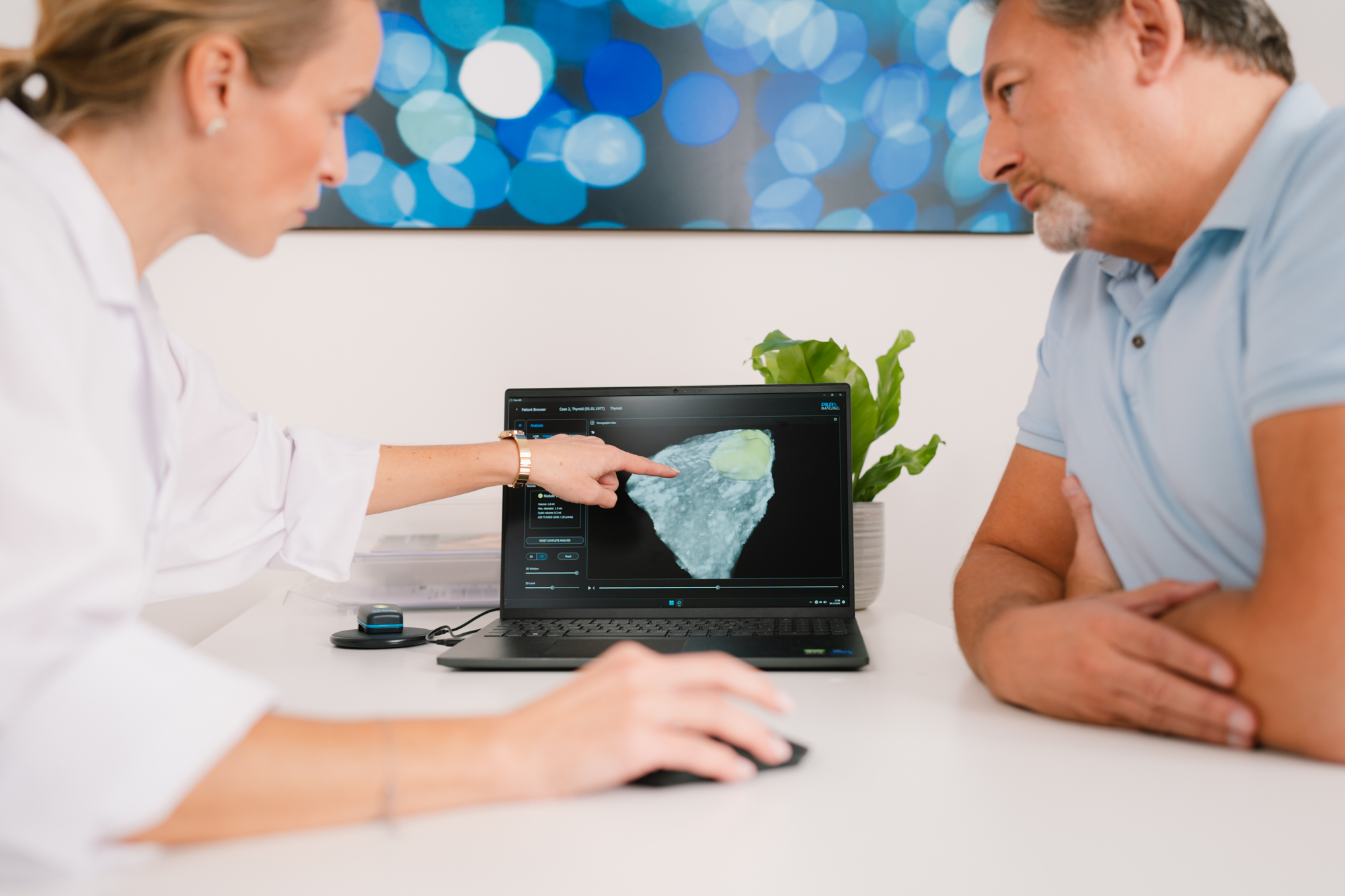 3D-Schilddrüsen-Ultraschall & KI-Analyse